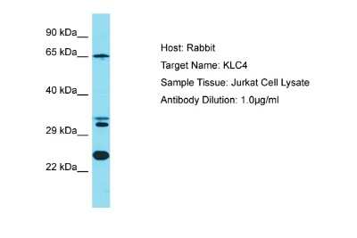 Western Blot: KLC4 Antibody [NBP2-87694]