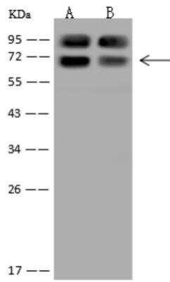 Western Blot: KLC4 Antibody [NBP3-06417]