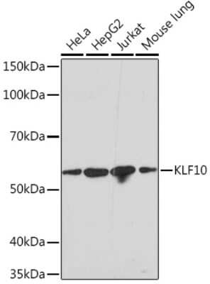 Western Blot: KLF10 Antibody (2Y1Q6) [NBP3-16133]