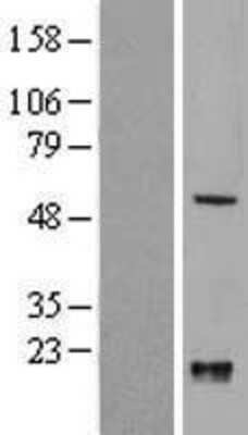 Western Blot: KLF10 Overexpression Lysate [NBL1-12312]