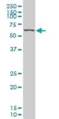 Western Blot: KLF11 Antibody (10C5) [H00008462-M02]