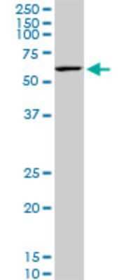 Western Blot: KLF11 Antibody (10C5) [H00008462-M02]