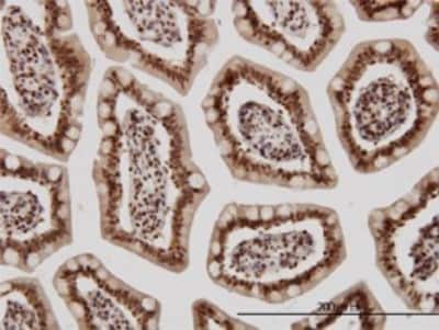 Immunohistochemistry-Paraffin: KLF11 Antibody (8F4) [H00008462-M01]