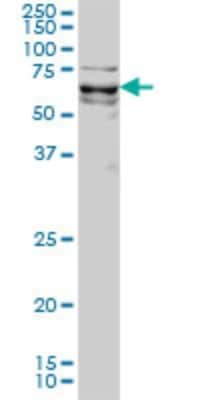 Western Blot: KLF11 Antibody (8F4) [H00008462-M01]