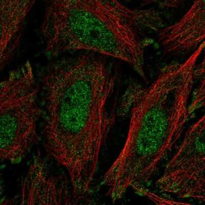 Immunocytochemistry/ Immunofluorescence: KLF11 Antibody [NBP2-58081]