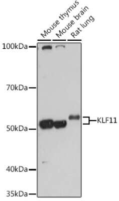 Western Blot: KLF11 AntibodyAzide and BSA Free [NBP3-15582]