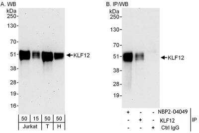 Immunoprecipitation: KLF12 Antibody [NBP2-04049]