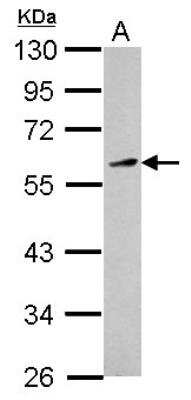 Western Blot: KLF12 Antibody [NBP2-17067]