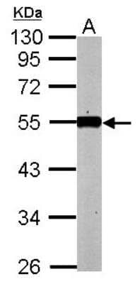 Western Blot: KLF12 Antibody [NBP2-17067]