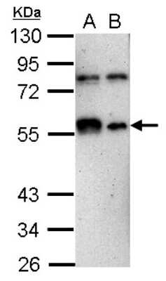 Western Blot: KLF12 Antibody [NBP2-17068]