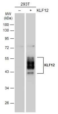 Western Blot: KLF12 Antibody [NBP2-17068]