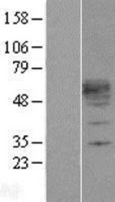 Western Blot: KLF12 Overexpression Lysate [NBP2-04324]