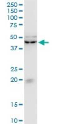 Western Blot: KLF13 Antibody (1D3) [H00051621-M01]