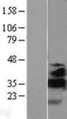 Western Blot: KLF13 Overexpression Lysate [NBL1-12316]