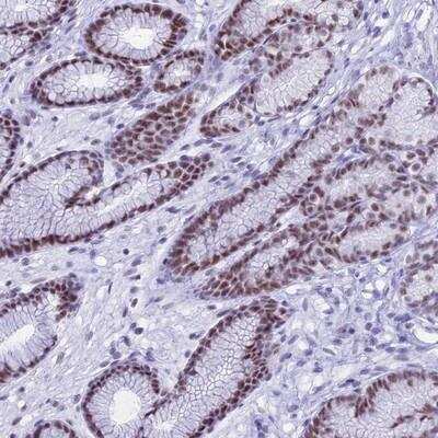 Immunohistochemistry-Paraffin: KLF14 Antibody [NBP1-92058]