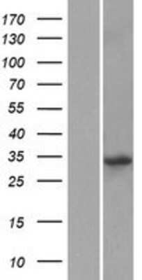 Western Blot: KLF14 Overexpression Lysate [NBP2-05638]