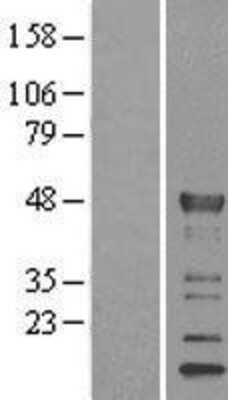 Western Blot: KLF15 Overexpression Lysate [NBL1-12317]