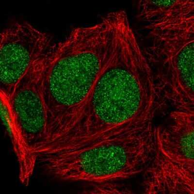 Immunocytochemistry/ Immunofluorescence: KLF16 Antibody [NBP2-30580]