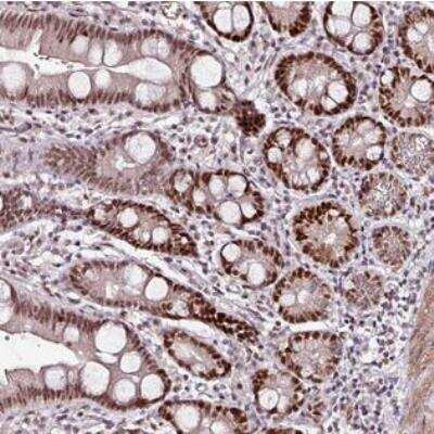 Immunohistochemistry-Paraffin: KLF16 Antibody [NBP2-30580]