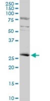 Western Blot: KLF16 Antibody [H00083855-D01P]