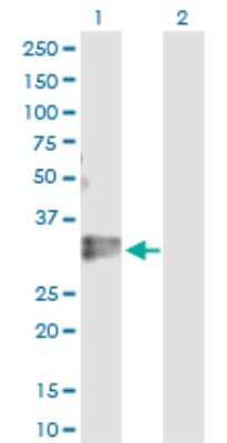 Western Blot: KLF16 Antibody [H00083855-D01P]
