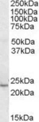 Western Blot: KLF16 Antibody [NB100-1049]