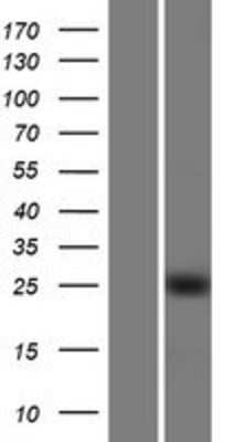 Western Blot: KLF16 Overexpression Lysate [NBP2-06101]