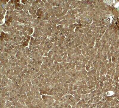 Immunohistochemistry: KLF17 Antibody - BSA Free [NBP2-82001]
