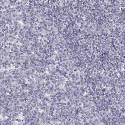 Immunohistochemistry-Paraffin: KLF17 Antibody [NBP1-81917]