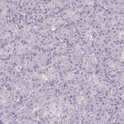 Immunohistochemistry-Paraffin: KLF17 Antibody [NBP1-81917]