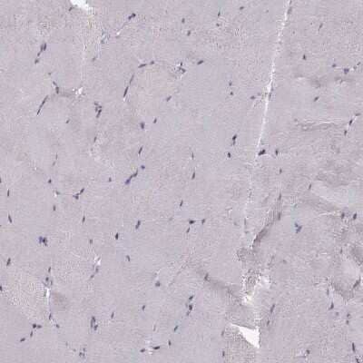 Immunohistochemistry-Paraffin: KLF17 Antibody [NBP1-81917]