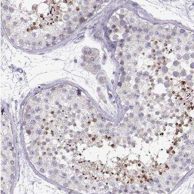 Immunohistochemistry-Paraffin: KLF17 Antibody [NBP1-81917]