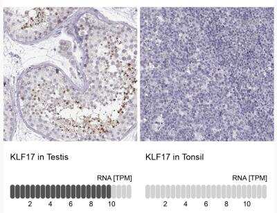 Immunohistochemistry-Paraffin: KLF17 Antibody [NBP1-81917]