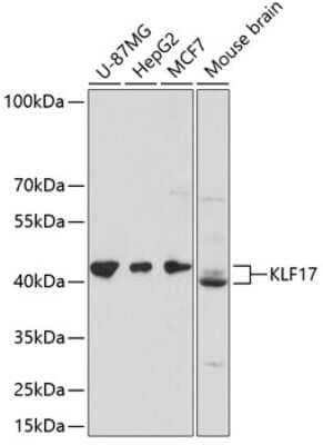 Western Blot: KLF17 AntibodyAzide and BSA Free [NBP3-04848]