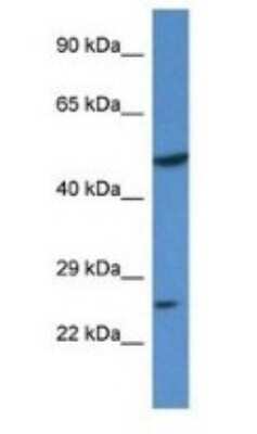 Western Blot: KLF17 Antibody [NBP1-80428]