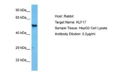 Western Blot: KLF17 Antibody [NBP1-80428]