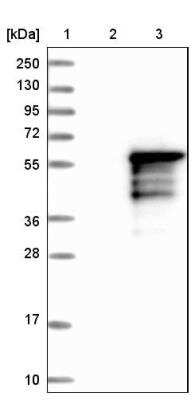 Western Blot: KLF17 Antibody [NBP1-81917]