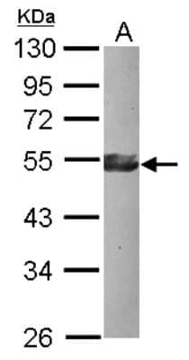 Western Blot: KLF17 Antibody [NBP2-17069]