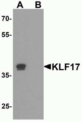 Western Blot: KLF17 AntibodyBSA Free [NBP2-82001]