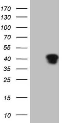 Western Blot: KLF2 Antibody (OTI3A10) [NBP2-45510]