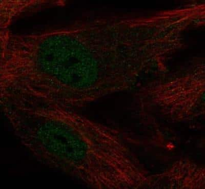 Immunocytochemistry/ Immunofluorescence: KLF2 Antibody [NBP2-31619]