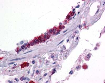 Immunohistochemistry: KLF2 Antibody [NBP3-10956]