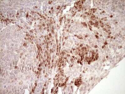 Immunohistochemistry: KLF2 Antibody (OTI3A10) - Azide and BSA Free [NBP2-71597]