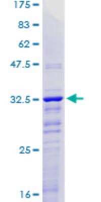 SDS-PAGE: Recombinant Human KLF2 GST (N-Term) Protein [H00010365-Q03]