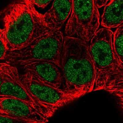 Immunocytochemistry/ Immunofluorescence: KLF3 Antibody [NBP2-57746]