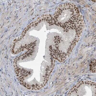 Immunohistochemistry-Paraffin: KLF3 Antibody [NBP2-48937]