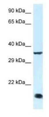 Western Blot: KLF3 Antibody [NBP1-82403]