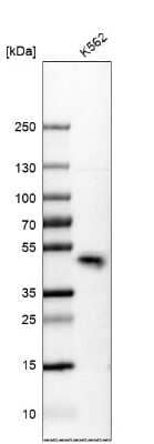 Western Blot: KLF3 Antibody [NBP2-48937]