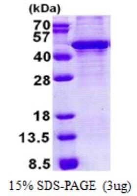 SDS-PAGE: Recombinant Human KLF3 His Protein [NBP2-23175]