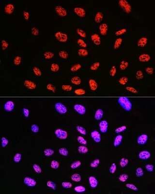 Immunocytochemistry/ Immunofluorescence: KLF4 Antibody (7B7U1) [NBP3-15469]